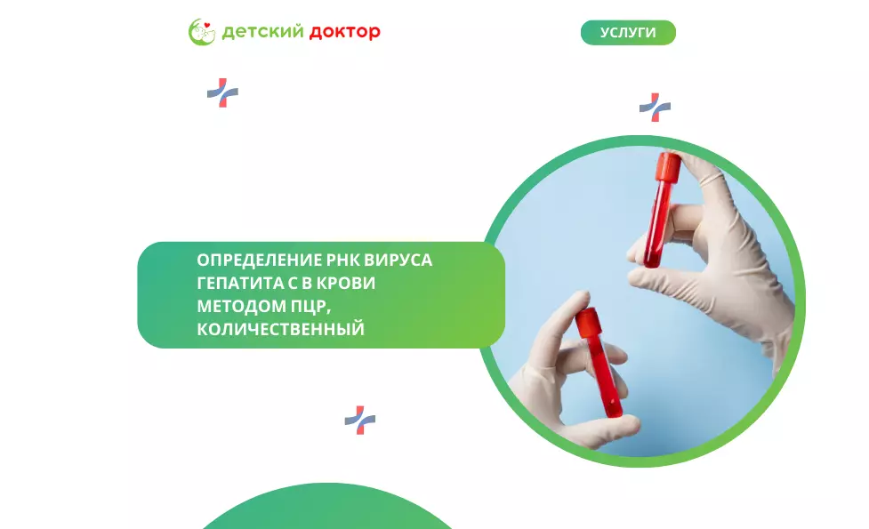 Определение РНК вируса гепатита С в крови методом ПЦР, качественный